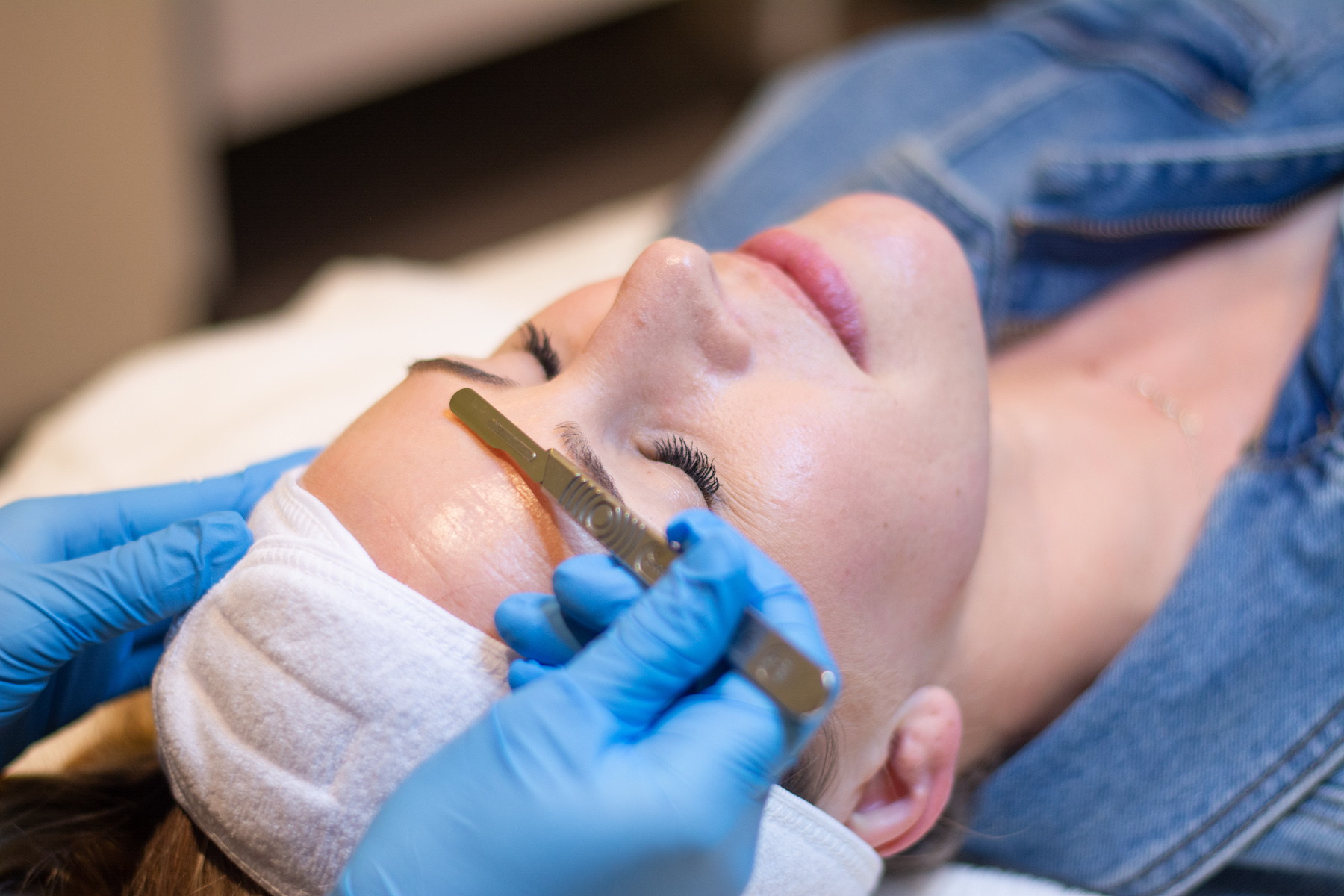 best dermaplaning walnut creek changes
